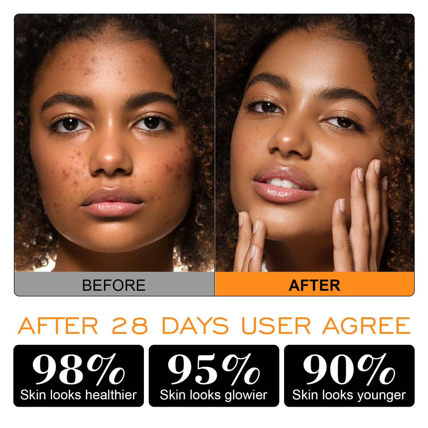 ZealSea Turmeric Clay Mask for Face with Vitamin C for Dark Spots 4.23 Oz